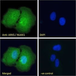ARK5 Polyclonal Antibody, Invitrogen 100 &mu;g; Unconjugated:Antibodies,