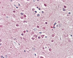 Invitrogen CHRNB2 Polyclonal Antibody 100 &mu;g; Unconjugated:Antibodies,