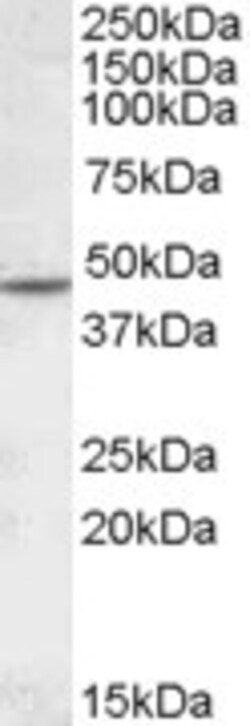 Invitrogen CHRNB2 Polyclonal Antibody 100 &mu;g; Unconjugated:Antibodies,