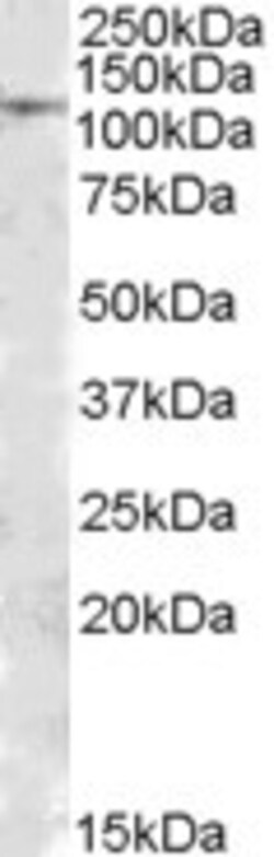Invitrogen MTHFD1 Polyclonal Antibody 100 &mu;g; Unconjugated:Antibodies,