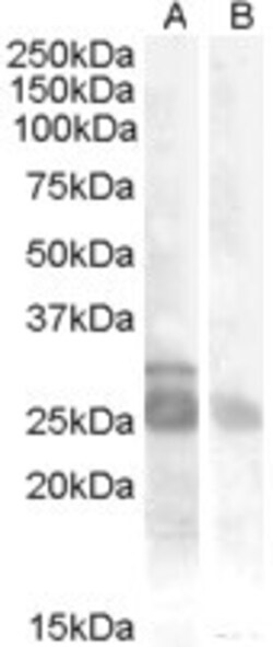 Invitrogen MYF5 Polyclonal Antibody 100 &mu;g; Unconjugated:Antibodies,
