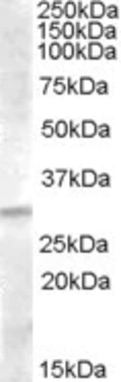 Invitrogen IGFBP4 Polyclonal Antibody 100 &mu;g; Unconjugated:Antibodies,