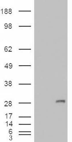Invitrogen IGFBP6 Polyclonal Antibody 100 &mu;g; Unconjugated:Antibodies,
