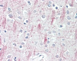 Invitrogen GPR125 Polyclonal Antibody 100 &mu;g | Buy Online | Invitrogen&trade; | Fisher Scientific