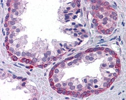 Invitrogen KPNA6 Polyclonal Antibody 100 μg; Unconjugated:Antibodies,