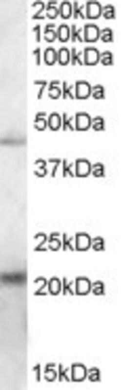 Invitrogen ERP44 Polyclonal Antibody 100 &mu;g; Unconjugated:Antibodies,