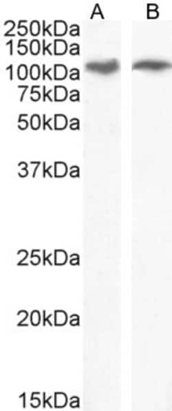Invitrogen IRE1 alpha Polyclonal Antibody 100 &mu;g; Unconjugated:Antibodies,