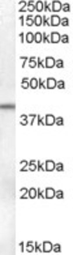 Invitrogen SERPINB6 Polyclonal Antibody 100 &mu;g; Unconjugated:Antibodies,