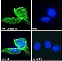 Invitrogen Cathepsin K Polyclonal Antibody 100 &mu;g; Unconjugated:Antibodies,