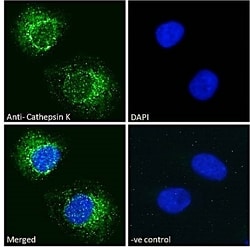 Invitrogen Cathepsin K Polyclonal Antibody 100 &mu;g; Unconjugated:Antibodies,