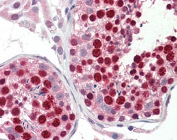 Invitrogen ABCA9 Polyclonal Antibody 100 μg; Unconjugated:Antibodies,