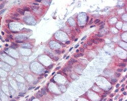 Invitrogen RELM beta Polyclonal Antibody 100 &mu;g; Unconjugated:Antibodies,