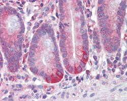 Invitrogen RELM beta Polyclonal Antibody 100 &mu;g; Unconjugated:Antibodies,