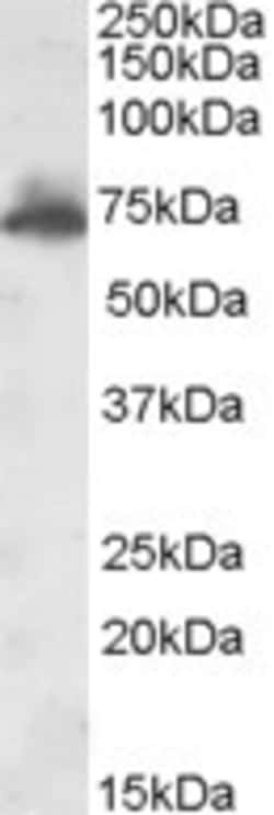 Invitrogen AKAP10 Polyclonal Antibody 100 &mu;g; Unconjugated:Antibodies,