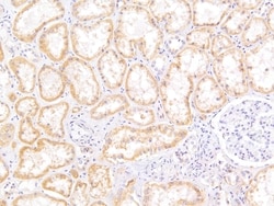 Invitrogen MRP5 Polyclonal Antibody 100 &mu;g; Unconjugated:Antibodies,