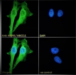 Invitrogen ABCC11 Polyclonal Antibody 100 &mu;g; Unconjugated:Antibodies,