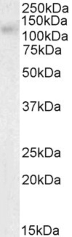 Invitrogen ABCC11 Polyclonal Antibody 100 &mu;g; Unconjugated:Antibodies,