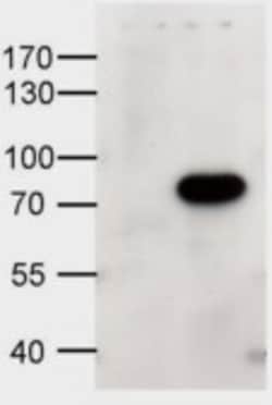 Invitrogen ABCD1 Polyclonal Antibody 100 &mu;g | Buy Online | Invitrogen&trade; | Fisher Scientific