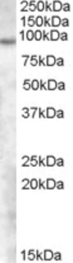 Invitrogen TCHHL1 Polyclonal Antibody 100 &mu;g; Unconjugated:Antibodies,