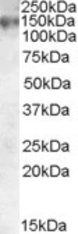 Invitrogen MRP1 Polyclonal Antibody 100 &mu;g; Unconjugated:Antibodies,