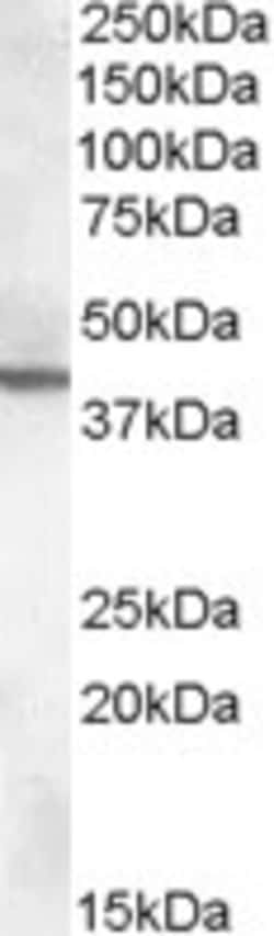 Invitrogen ABHD12 Polyclonal Antibody 100 &mu;g; Unconjugated:Antikroppar