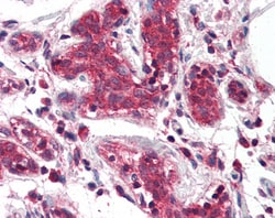 Invitrogen DAGLA Polyclonal Antibody 100 &mu;g; Unconjugated:Antibodies,