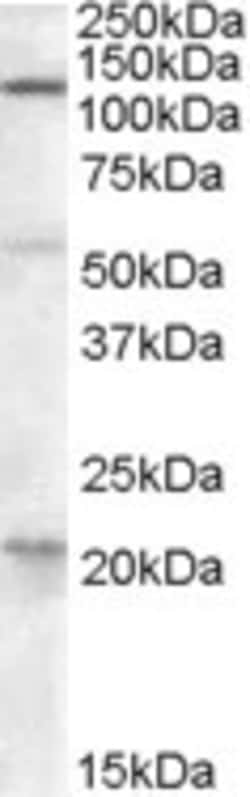 Invitrogen DAGLA Polyclonal Antibody 100 &mu;g; Unconjugated:Antibodies,