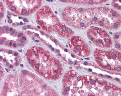 Invitrogen TRPC4 Polyclonal Antibody 100 &mu;g; Unconjugated:Antibodies,