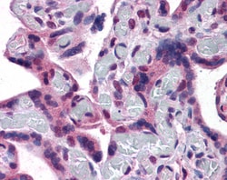Invitrogen TRPC4 Polyclonal Antibody 100 &mu;g; Unconjugated:Antibodies,