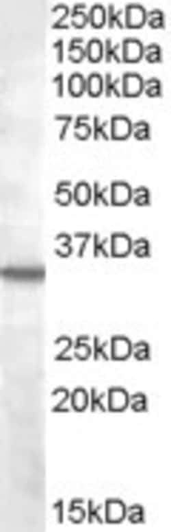 Invitrogen B1 Bradykinin Receptor Polyclonal Antibody 100 &mu;g; Unconjugated:Antibodies,