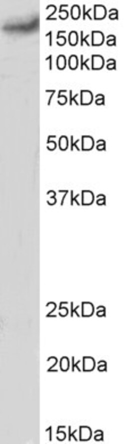 Invitrogen CaV1.2 Polyclonal Antibody 100 &mu;g; Unconjugated:Anticuerpos