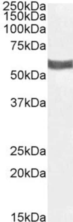 Invitrogen P2X4 Polyclonal Antibody 100 &mu;g; Unconjugated:Antibodies,