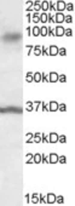 Invitrogen ANKK1 Polyclonal Antibody 100 &mu;g; Unconjugated:Antibodies,