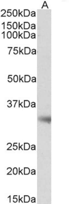 Invitrogen Monoacylglycerol Lipase Polyclonal Antibody 100 &mu;g; Unconjugated:Antibodies,