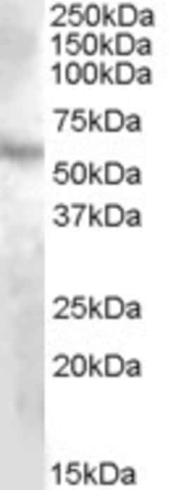 Invitrogen DMP1 Polyclonal Antibody 100 &mu;g | Buy Online | Invitrogen&trade; | Fisher Scientific