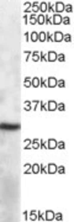 Invitrogen APOBEC1 Polyclonal Antibody 100 &mu;g; Unconjugated:Antibodies,