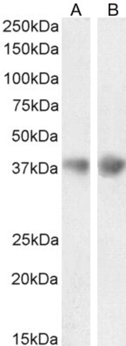 Invitrogen Apolipoprotein J Polyclonal Antibody 100 &mu;g; Unconjugated:Antibodies,