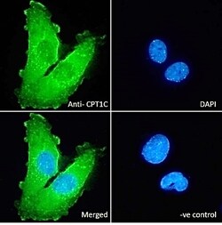 Invitrogen CPT1C Polyclonal Antibody 100 &mu;g; Unconjugated:Antibodies,