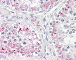 Invitrogen CPT1C Polyclonal Antibody 100 &mu;g; Unconjugated:Antibodies,