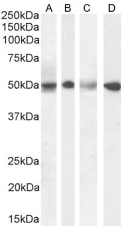 Invitrogen SEPT6 Polyclonal Antibody 100 &mu;g; Unconjugated:Antibodies,