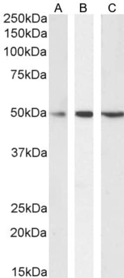 Invitrogen SEPT6 Polyclonal Antibody 100 &mu;g; Unconjugated:Antibodies,
