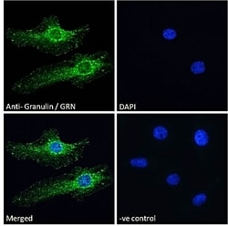 Invitrogen Granulins Polyclonal Antibody 100 &mu;g; Unconjugated:Antibodies,