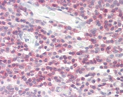 Invitrogen DPM1 Polyclonal Antibody 100 μg; Unconjugated:Antibodies,