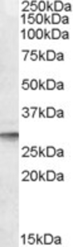Invitrogen DPM1 Polyclonal Antibody 100 μg; Unconjugated:Antibodies,