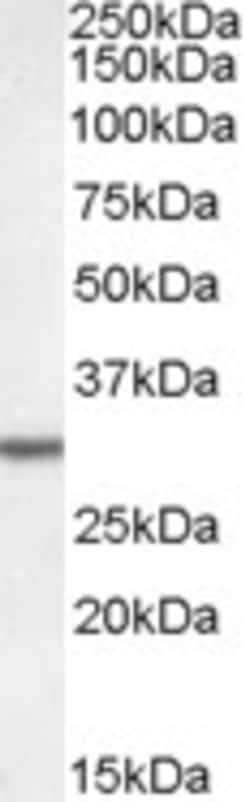 Invitrogen DPM1 Polyclonal Antibody 100 &mu;g; Unconjugated:Antibodies,