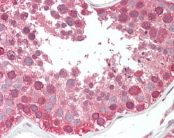 Invitrogen COG7 Polyclonal Antibody 100 &mu;g; Unconjugated:Antibodies,