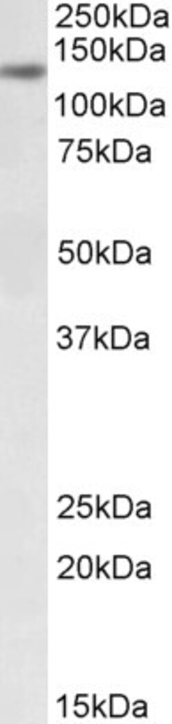 DIAPH1 Polyclonal Antibody, Invitrogen 100 μg; Unconjugated:Antibodies,