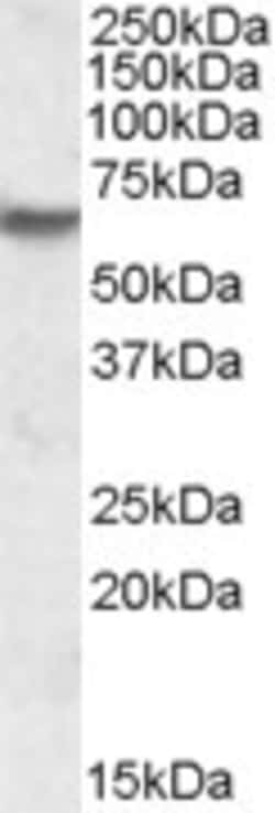 Invitrogen IMPDH2 Polyclonal Antibody 100 &mu;g; Unconjugated:Antibodies,