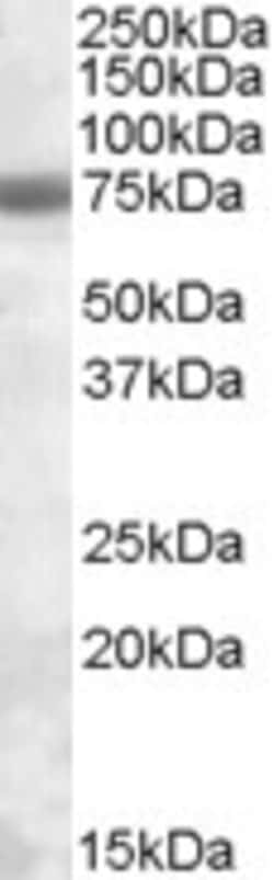 Invitrogen PMSCL1 Polyclonal Antibody 100 &mu;g; Unconjugated:Antibodies,