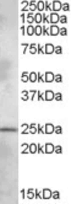 Invitrogen PHR1 Polyclonal Antibody 100 &mu;g; Unconjugated:Antibodies,